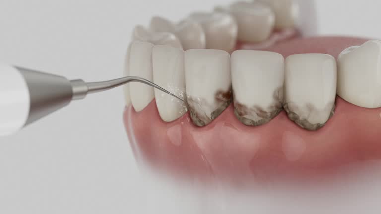Reliable Dental contractor in Hagerstown, IN by Dentist Open Now